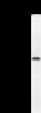 TRIOBP Antibody (clone 2438C1a)