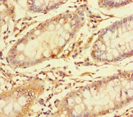 Polyclonal Rabbit anti-Human Carboxylesterase 3 / CES3 Antibody (IHC, IF)