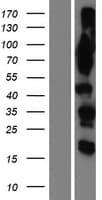 OSBPL9 Protein (Over-Expression Lysate Myc-DDK (Flag))