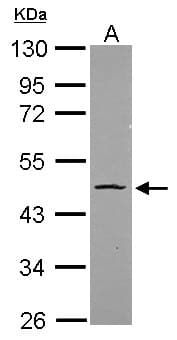 IHC-plus™ Polyclonal Rabbit anti-Human POU5F1 / OCT4 Antibody (IHC, IF, WB)