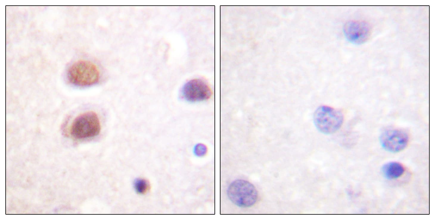 Polyclonal Rabbit anti-Human MAPK14 / p38 Antibody (phospho-Tyr322, IHC, WB)