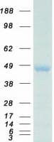 Human HOXA10 Protein (Recombinant Myc-DDK (Flag))