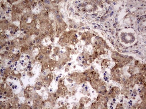 Monoclonal Mouse anti-Human GLI / GLI1 Antibody (clone OTI2E1, aa755-1106, IHC, WB)