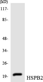 HSPB2 / HSP27 Antibody (aa94-143)