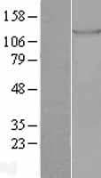 TIE1 / TIE Protein (Over-Expression Lysate Myc-DDK (Flag))