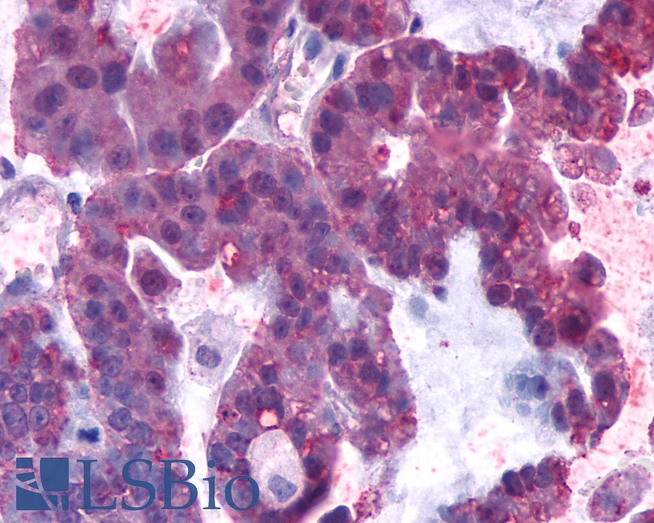 PathPlus™ Polyclonal Rabbit anti-Human CNR1 / CB1 Antibody (Cytoplasmic Domain, IHC)