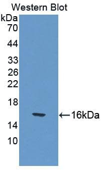 CUBN / Cubilin Antibody (aa98-207)