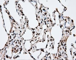 APP / Beta Amyloid Precursor Antibody (clone OTI2B10)