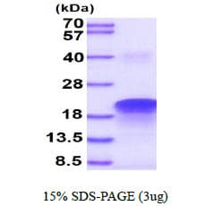 Human VEGFA / VEGF Protein (Recombinant)