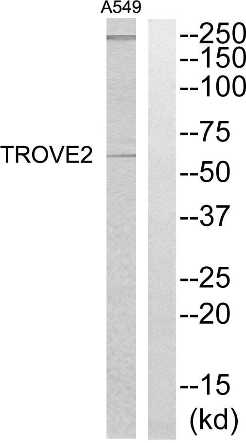 Polyclonal Rabbit anti-Human TROVE2 Antibody (WB)