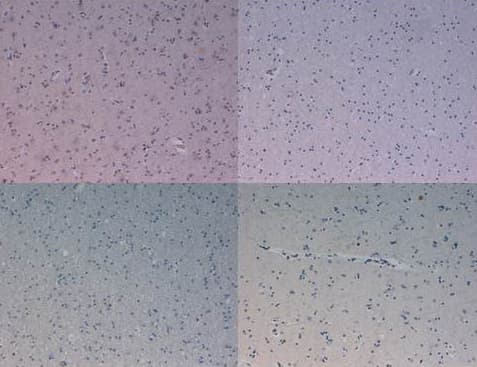 Kinesin Heavy Chain / KIF5B Antibody