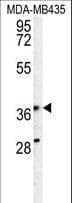 Polyclonal Rabbit anti-Human PRPSAP1 Antibody (aa30-59, WB)