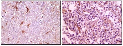 CIB1 / KIP Antibody (clone 5A1F5E12)
