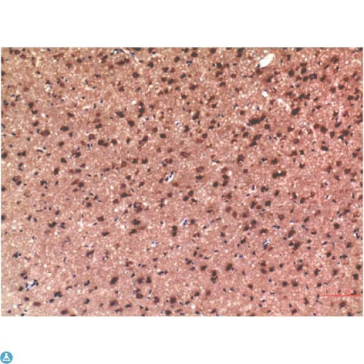 MAPT / Tau Antibody