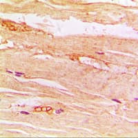 Polyclonal Rabbit anti-Human SLC2A4 / GLUT-4 Antibody (Internal, IHC, WB)