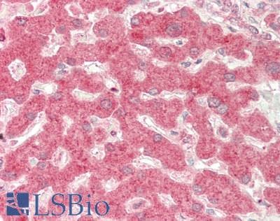 IHC-plus™ Polyclonal Rabbit anti-Human PFK2 / PFKFB3 Antibody (IHC, IF, WB)