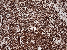 Monoclonal Mouse anti-Human HNRPM / HNRNPM Antibody (clone OTI3F3, aa1-261, IHC, WB)