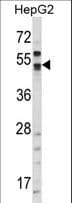 CA9 / Carbonic Anhydrase IX Antibody (aa63-90)