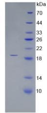 Human CORIN Protein (Recombinant His-T7)