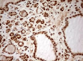 DOT1L / DOT1 Antibody (aa1008-1424, clone OTI6E7)