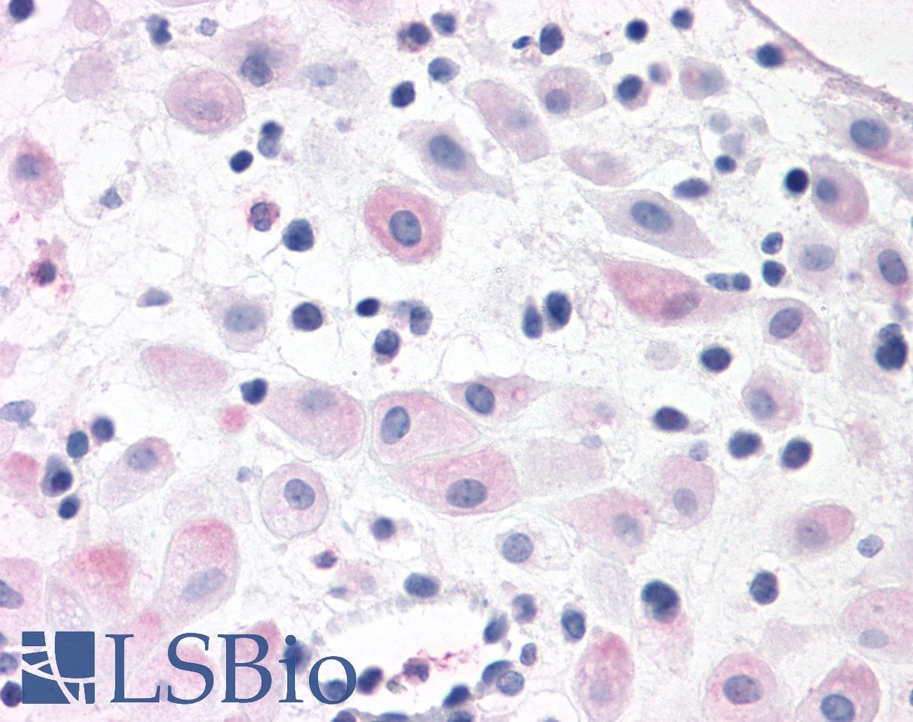 PathPlus™ BRS3 Antibody (N-Terminus)