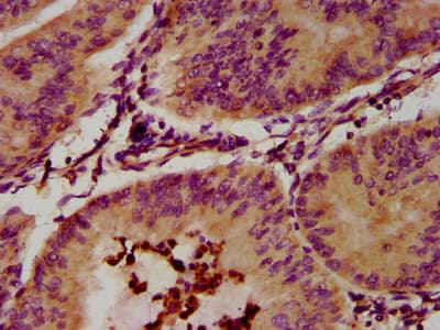 Polyclonal Rabbit anti-Human Eosinophil Peroxidase / EPX Antibody (IHC)