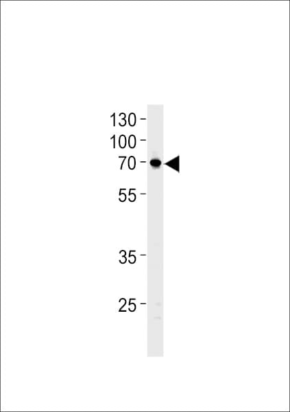 NTN1 / Netrin 1 Antibody (aa568-596)