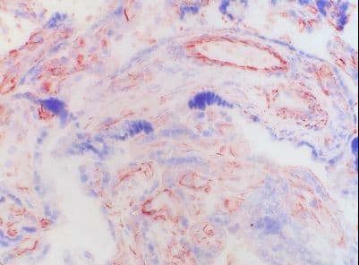 Monoclonal Mouse CTGF Antibody (clone 2154-60, IHC)