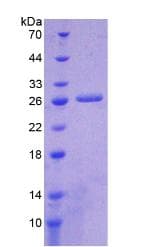 Human ICA69 / ICA1 Protein (Recombinant His-S)