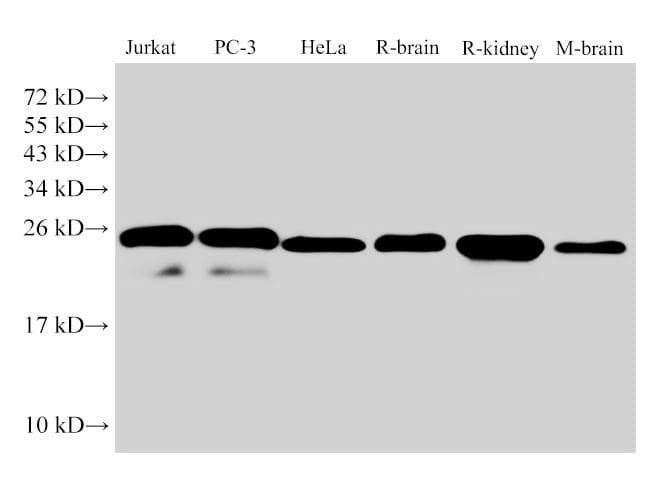 Polyclonal Rabbit anti-Mouse GSTP1 / GST Pi Antibody (IHC, WB)