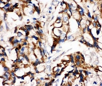 MAP2K1 / MKK1 / MEK1 Antibody (aa353-367)