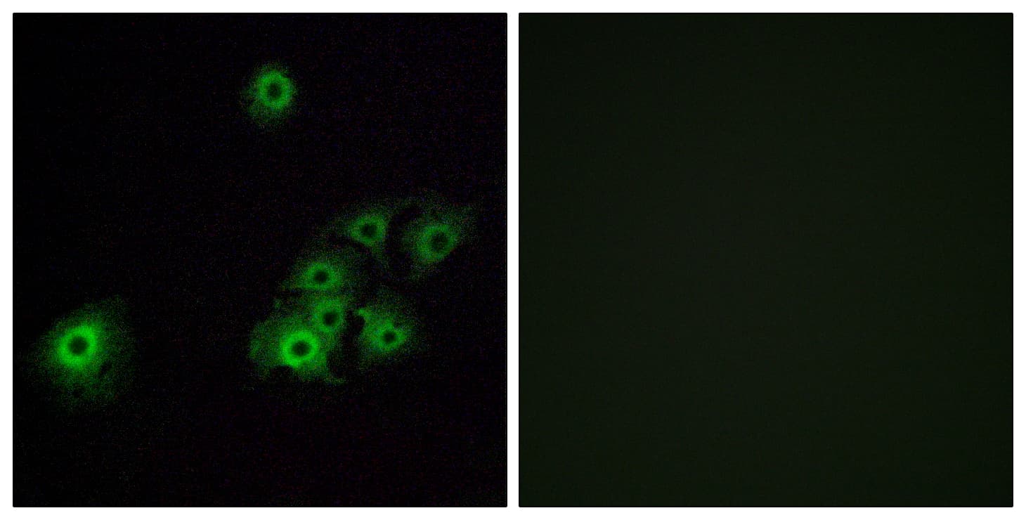 OR4C15 Antibody (aa261-310)