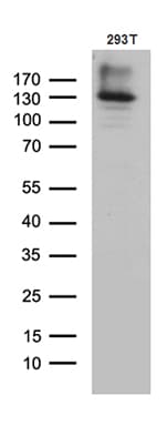 COL6A1 / Collagen VI Alpha 1 Antibody (aa752-835, clone OTI1G8)
