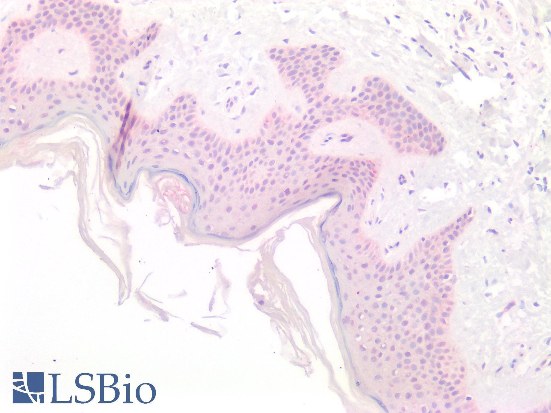 IHC-plus™ Polyclonal Rabbit anti-Human CTSK / Cathepsin K Antibody (IHC)