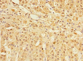 COMMD1 Antibody
