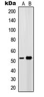 PTGER4 / EP4 Antibody (Internal)