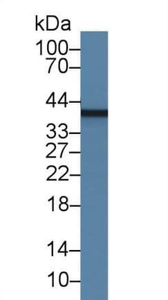 MBP / Myelin Basic Protein Antibody (clone C3)