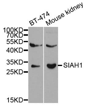 SIAH1 Antibody