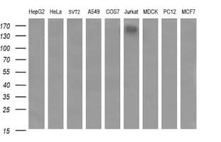 Monoclonal Mouse anti-Human CD45 / LCA Antibody (clone OTI3E3, IF, WB)