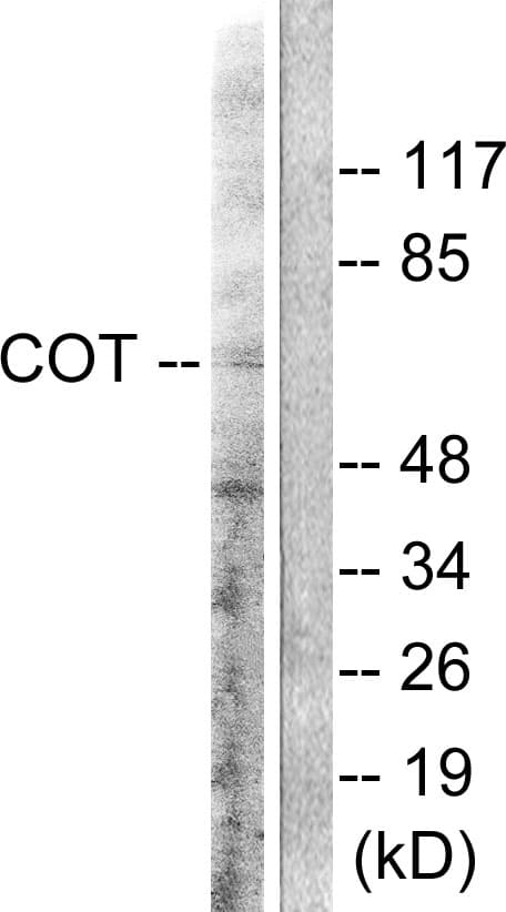 Polyclonal Rabbit anti-Human MAP3K8 / TPL2 Antibody (aa256-305, IHC, IF, WB)