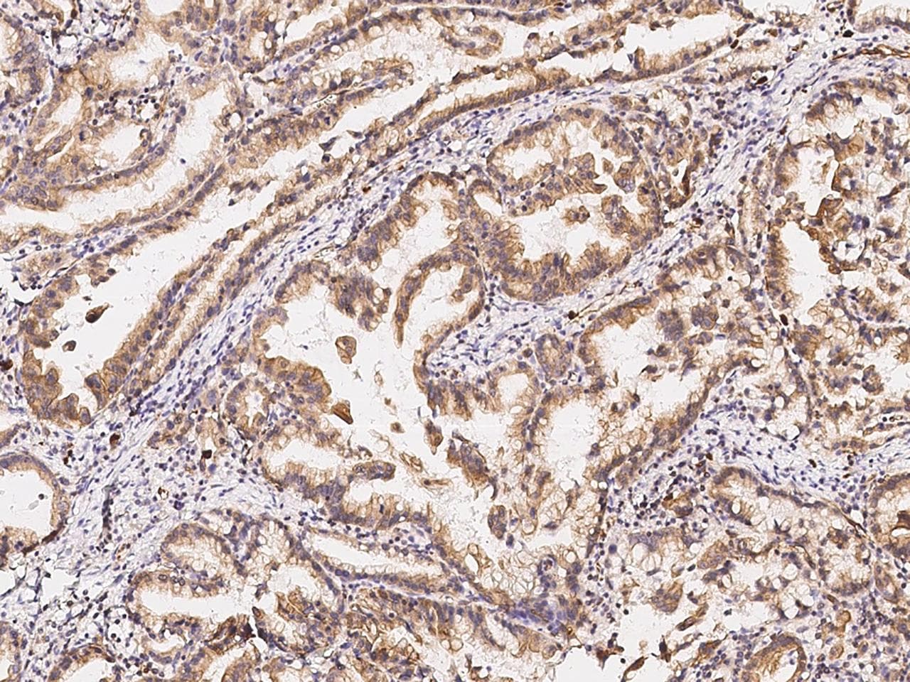 GASP2 / GPRASP2 Antibody (Preservative Free)
