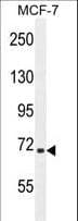 Polyclonal Rabbit anti-Human SEL1L Antibody (aa156-182, IHC, WB)