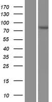 AACS Protein (Over-Expression Lysate Myc-DDK (Flag))