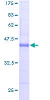 Human CHRAC1 Protein (Recombinant GST)