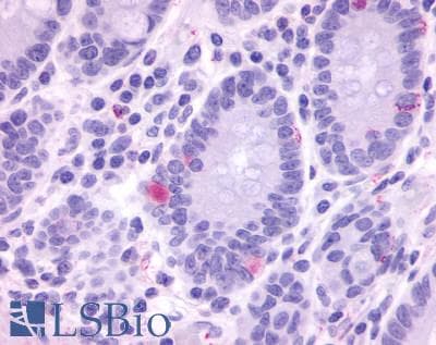 IHC-plus™ GPR148 Antibody (Cytoplasmic Domain)