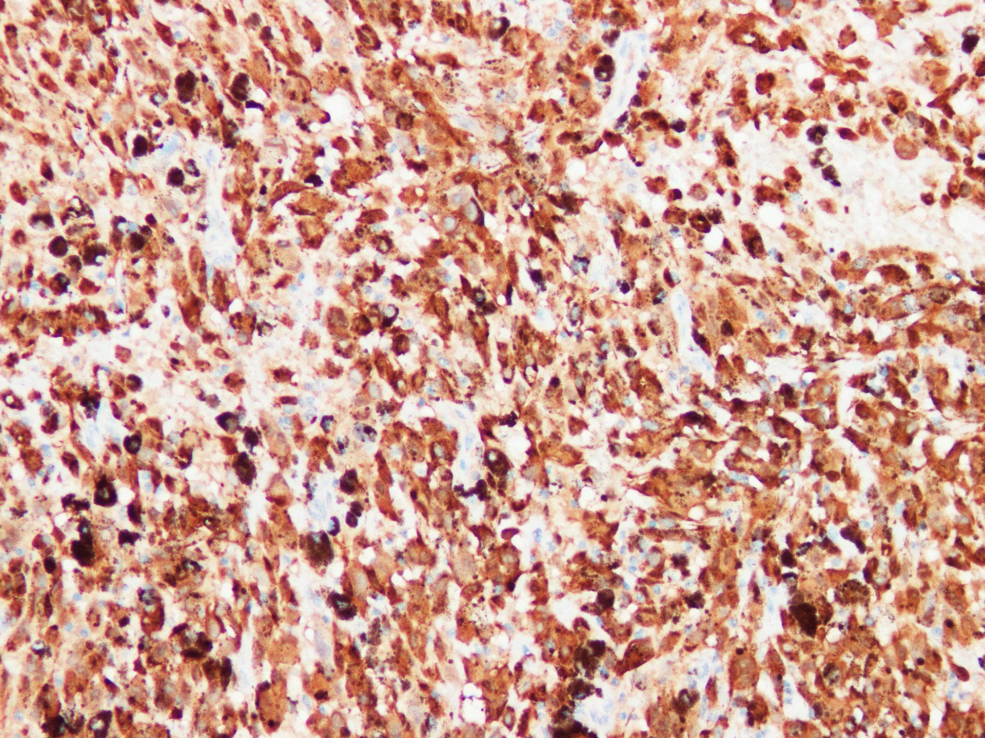 S100A1 / S100-A1 Antibody