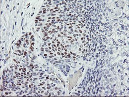 TP53 / p53 Antibody (clone OTI1D11, Carrier-free)