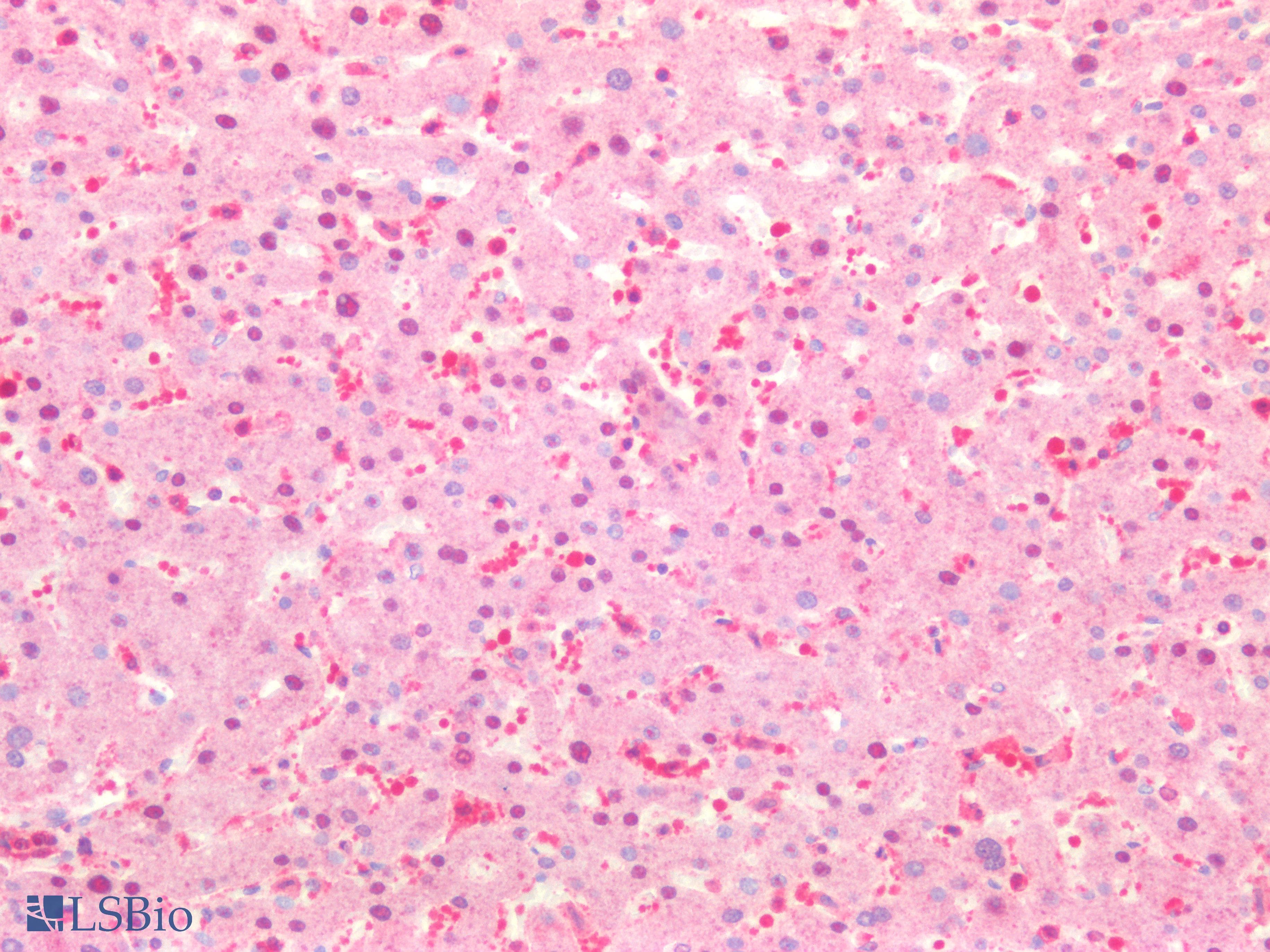 PathPlus™ IL6ST / CD130 / gp130 Antibody
