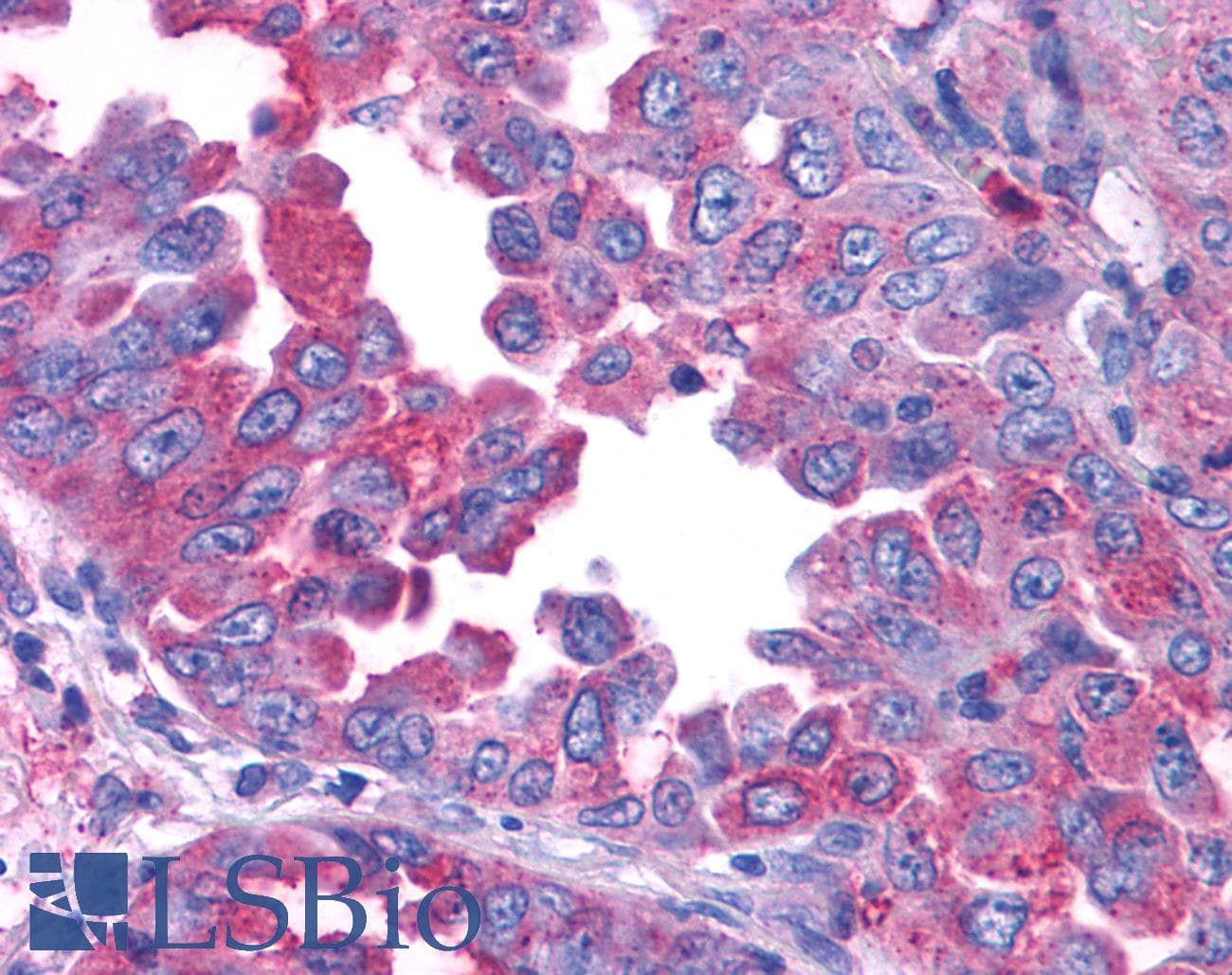 PathPlus™ CRFR1 / CRHR1 Antibody (N-Terminus)