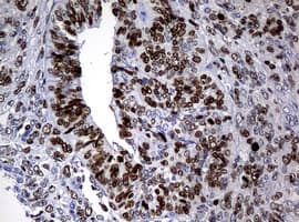 Monoclonal Mouse anti-Human MKI67 / Ki67 Antibody (clone OTI3B6, IHC)